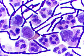 Pathogenic bacteria inactivated with ozone